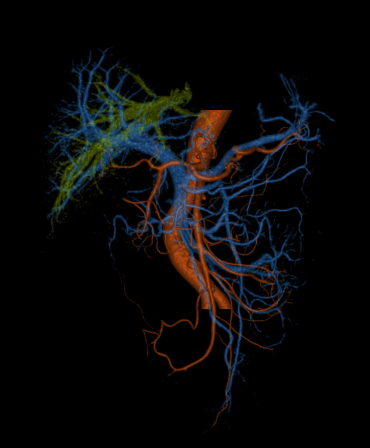 Color-rendered abdominal vascular post-processing visualization