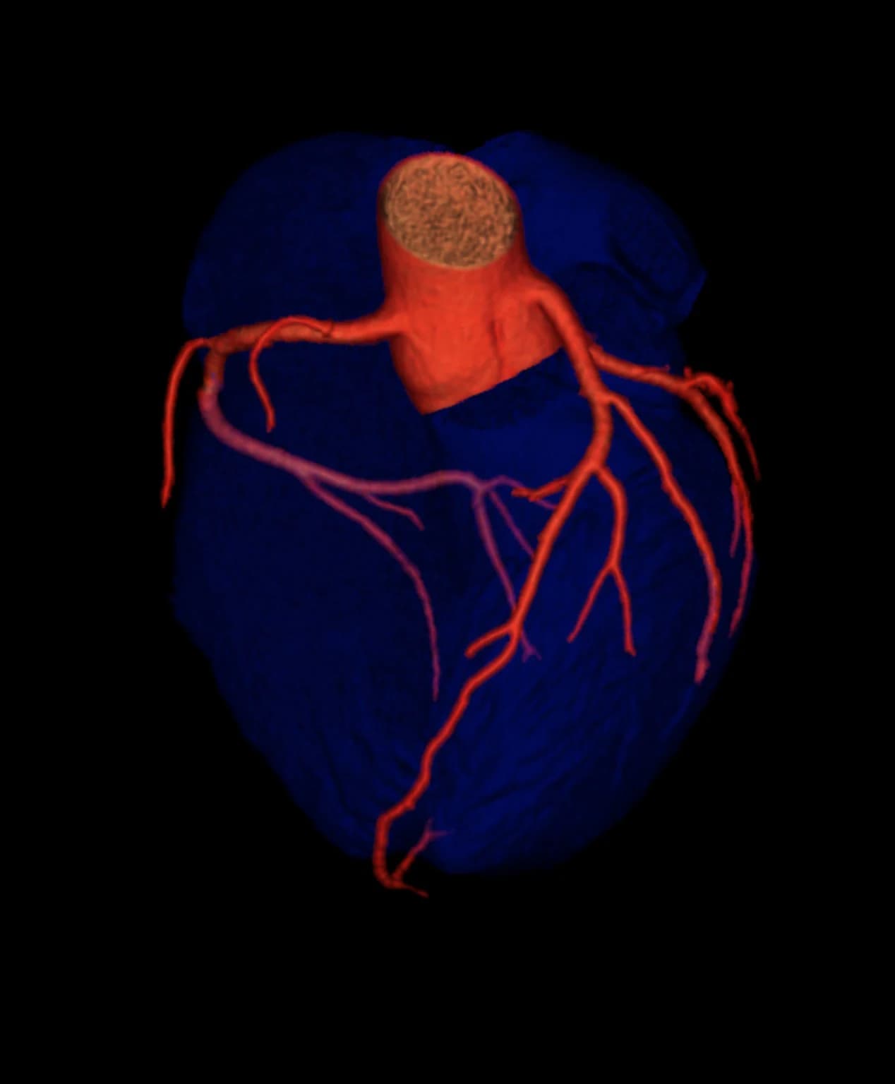 Color-rendered coronary CT visualization of cardiac and coronary vascular anatomy