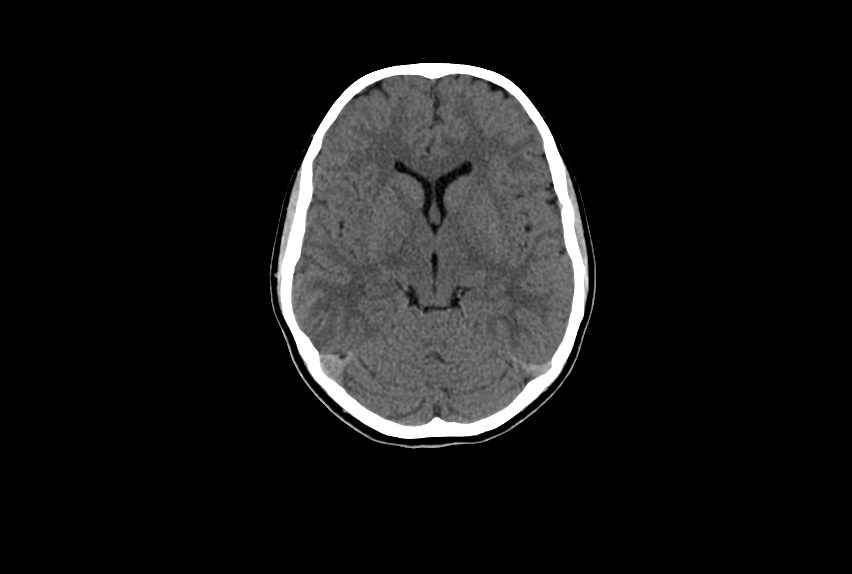 Axial CT brain image for imaging education